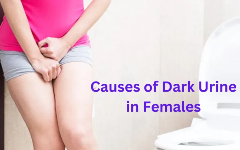 Causes of Dark Urine in Females